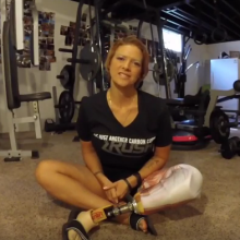 Are You Having Trouble Managing Your Residual Limb Volume?